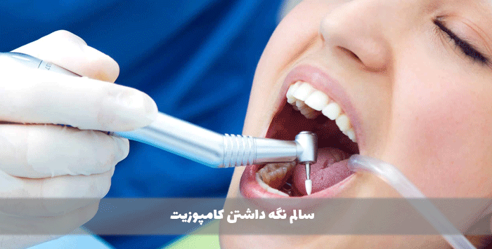 سالم نگه داشتن کامپوزیت