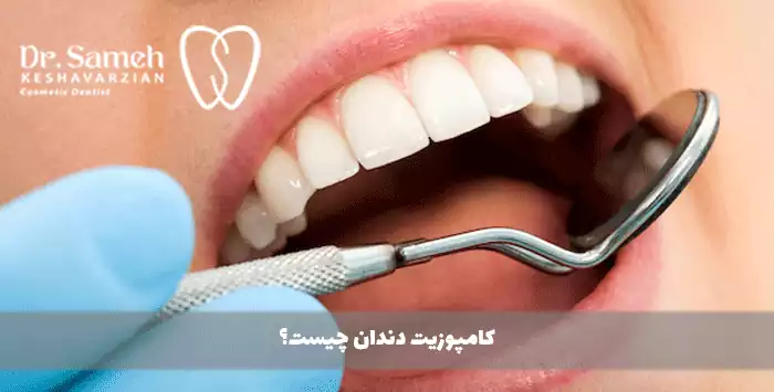 کامپوزیت دندان چیست