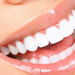 اصلاح طرح لبخند