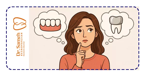 انتخاب گزینه مناسب بین روکش و لمینت انتخاب گزینه مناسب بین روکش و لمینت