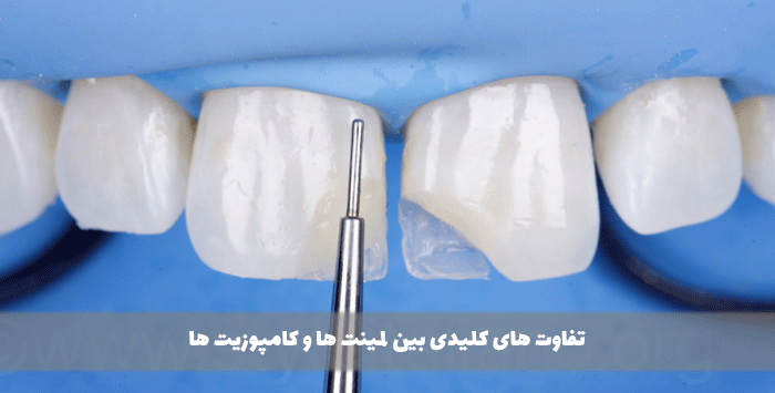 تفاوت های کلیدی بین لمینت ها و کامپوزیت ها