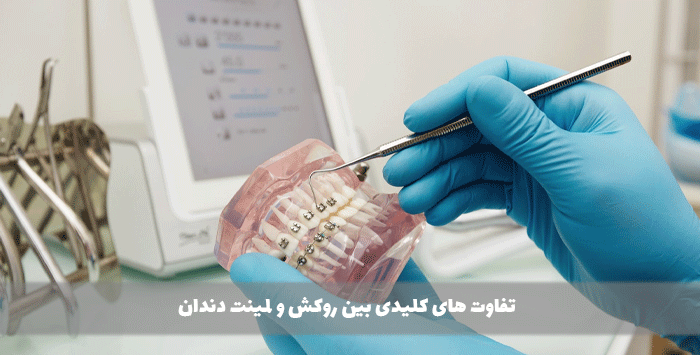 تفاوت های کلیدی بین روکش و لمینت دندان