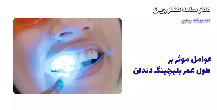 عوامل موثر بر طول عمر بلیچینگ دندان