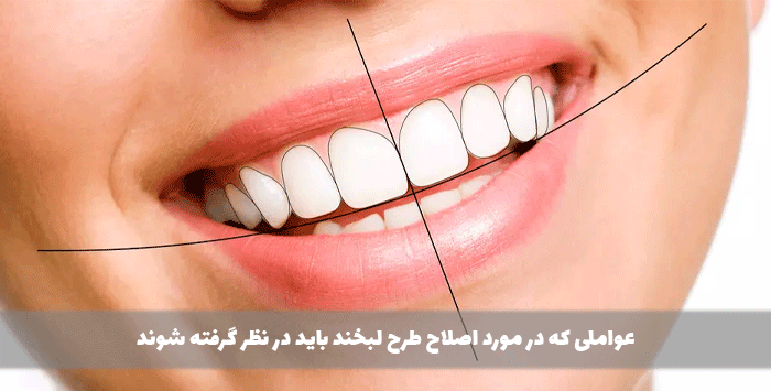 عواملی که در مورد اصلاح طرح لبخند باید در نظر گرفته شوند