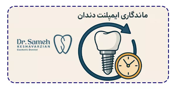 ماندگاری ایمپلنت دندان چقدر است؟