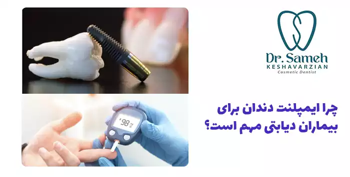 چرا ایمپلنت دندان برای بیماران دیابتی مهم است؟