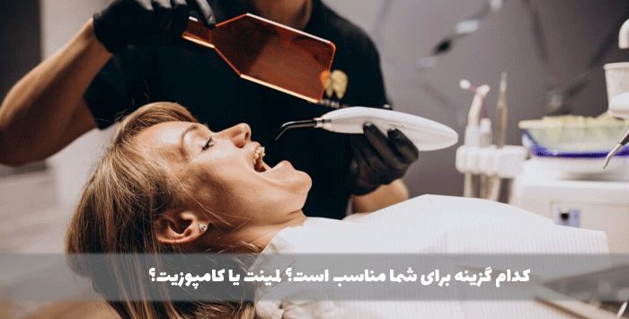  کدام گزینه برای شما مناسب است؟ لمینت یا کامپوزیت؟