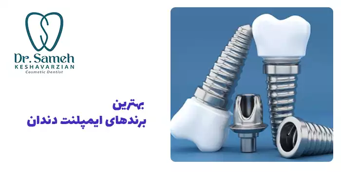  بهترین برندهای ایمپلنت دندان