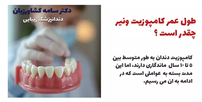 طول عمر کامپوزیت چقدر است