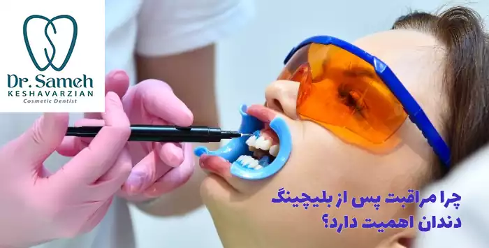 چرا مراقبت پس از بلیچینگ دندان اهمیت دارد؟