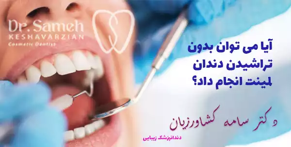 آیا می توان بدون تراشیدن دندان لمینت انجام داد؟