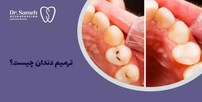 ترمیم دندان چیست؟