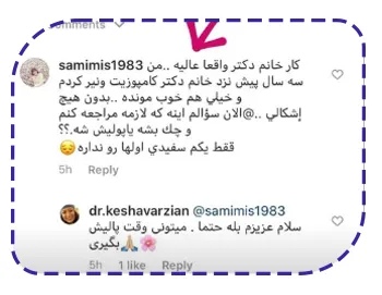 رضایت از کامپوزیت ونیر دندان رضایت از کامپوزیت ونیر دندان