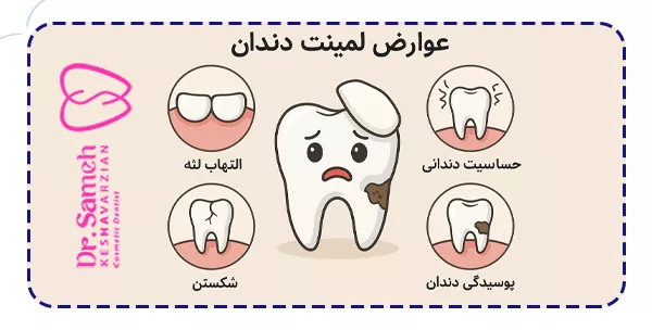 عوارض لمینت دندان چیست