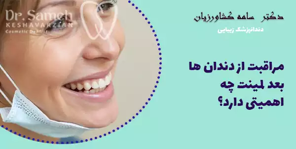 مراقبت از دندان ها بعد لمینت چه اهمیتی دارد؟