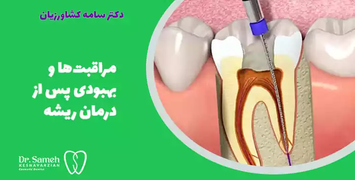 مراقبت‌ها و بهبودی پس از درمان ریشه