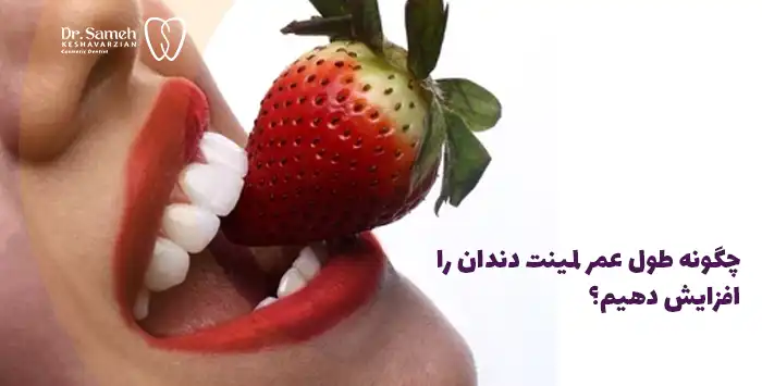 چگونه طول عمر لمینت دندان را افزایش دهیم؟