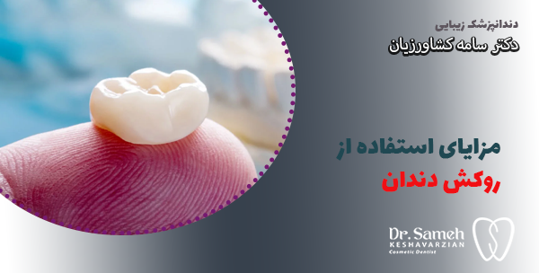 مزایای استفاده از روکش دندان  