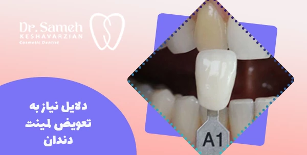 دلایل نیاز به تعویض لمینت دندان