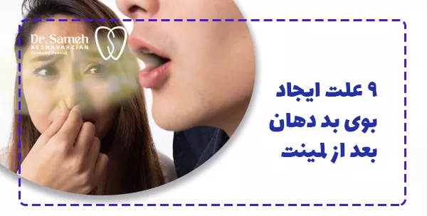 9 علت ایجاد بوی بد دهان بعد از لمینت