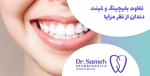  تفاوت بلیچینگ و لمینت دندان از نظر مزایا
