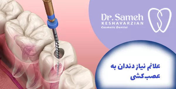 علائم نیاز دندان به عصب‌ کشی