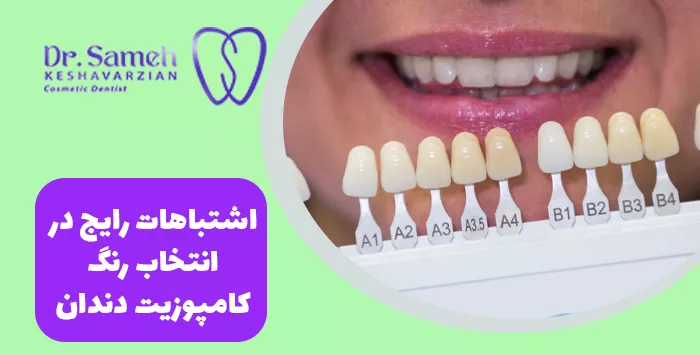 اشتباهات رایج در انتخاب رنگ کامپوزیت دندان