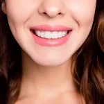 بهترین سن برای کامپوزیت دندان