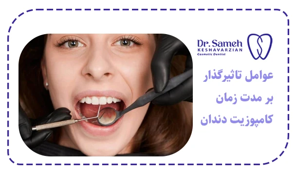 عوامل تاثیرگذار بر مدت زمان کامپوزیت دندان