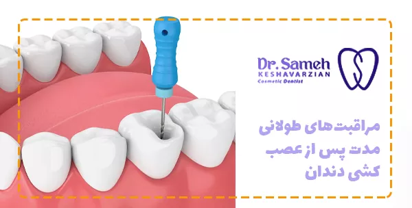 مراقبت‌های طولانی‌مدت پس از عصب‌کشی دندان