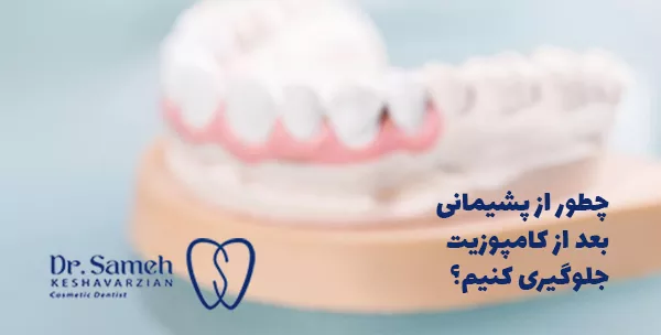 چطور از پشیمانی بعد از کامپوزیت جلوگیری کنیم؟