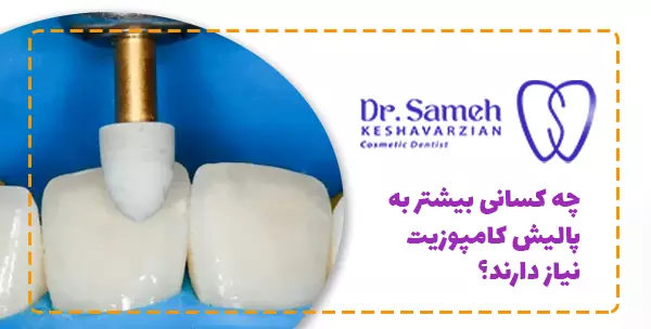 چه کسانی بیشتر به پالیش کامپوزیت نیاز دارند؟