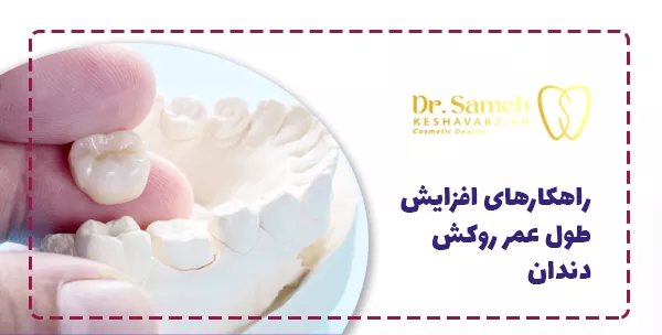 راهکارهای افزایش طول عمر روکش دندان
