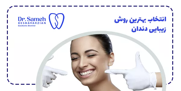انتخاب بهترین روش زیبایی دندان
