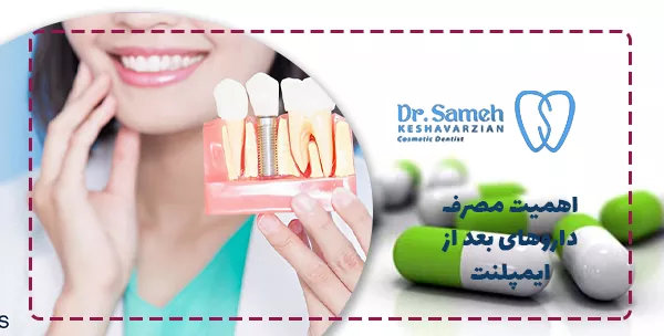 اهمیت مصرف داروهای بعد از ایمپلنت