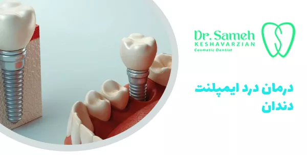 درمان درد ایمپلنت دندان