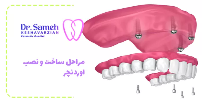 مراحل ساخت و نصب اوردنچر