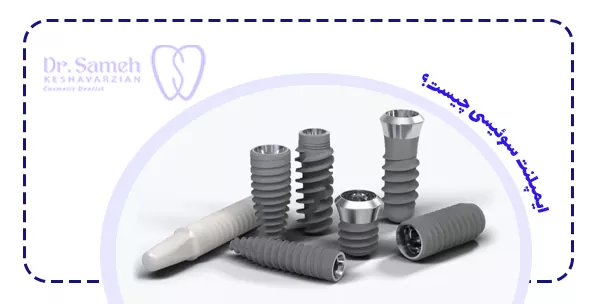 ایمپلنت سوئیسی چیست؟