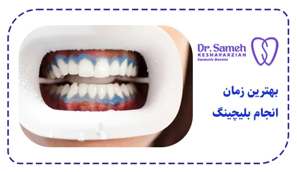 بهترین زمان انجام بلیچینگ