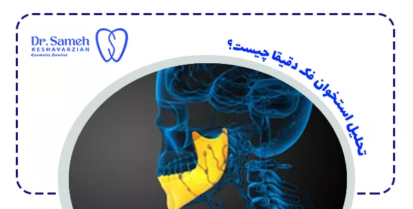 تحلیل استخوان فک دقیقا چیست؟
