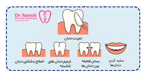 لمینت دندان چه کاربردی دارد؟ لمینت دندان چه کاربردی دارد؟