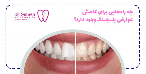 چه راه‌هایی برای کاهش عوارض بلیچینگ وجود دارد؟