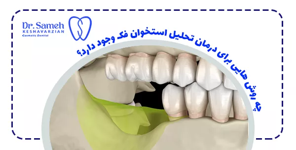 چه روش هایی برای درمان تحلیل استخوان فک وجود دارد؟