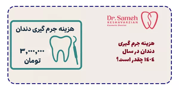 هزینه جرم گیری دندان در سال 1404 چقدر است؟