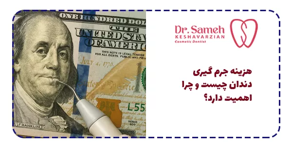 هزینه جرم گیری دندان چیست و چرا اهمیت دارد؟