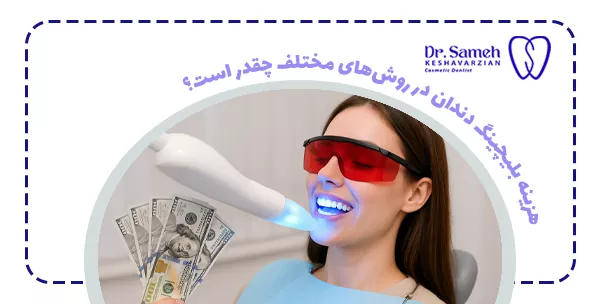 هزینه‌ بلیچینگ دندان در روش‌های مختلف چقدر است؟