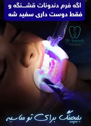 کاندیدای بلیچینگ دندان کاندیدای بلیچینگ دندان