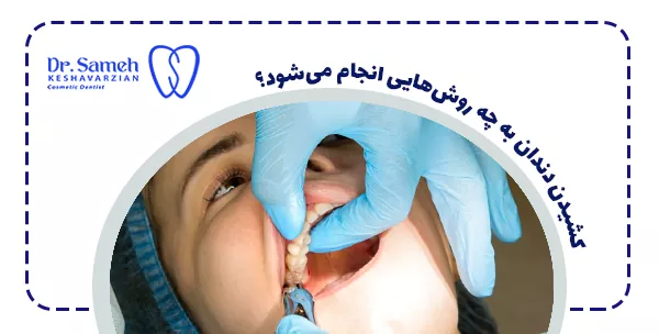 کشیدن دندان به چه روش‌هایی انجام می‌شود؟
