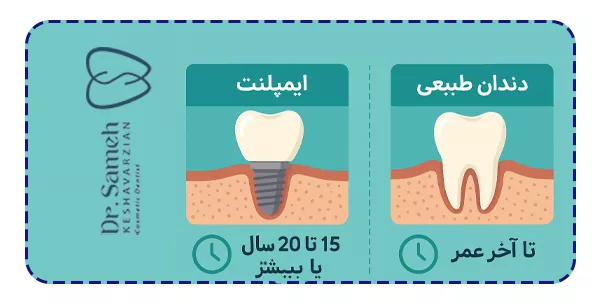 تفاوت ماندگاری ایمپلنت با دندان طبیعی
